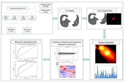 Pre-operative Prediction of Ki-67 Expression in Various Histological Subtypes of Lung Adenocarcinoma Based on CT Radiomic Features